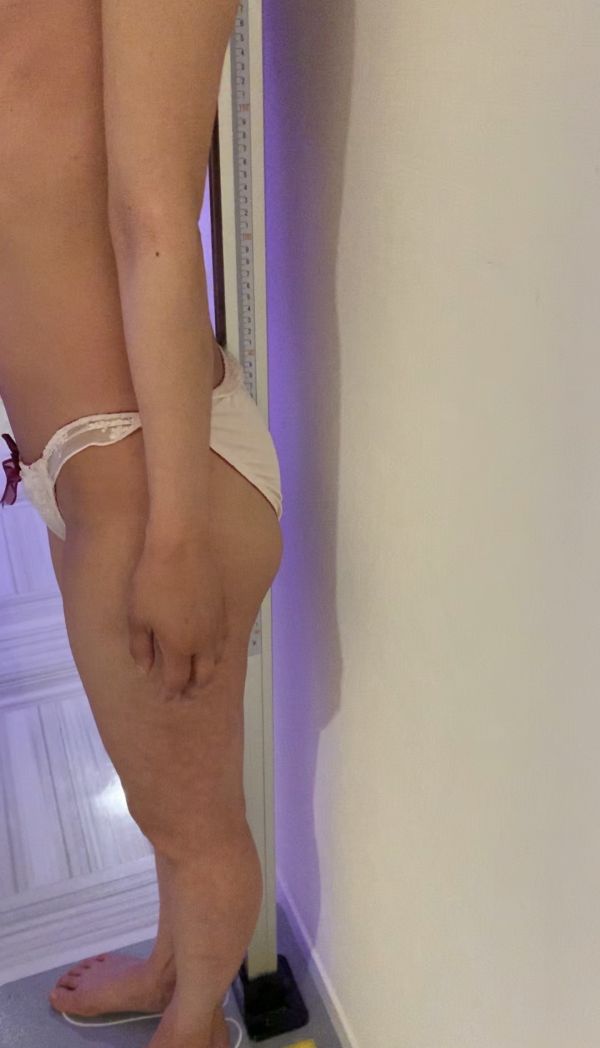 脇が甘かった… | 脱いだときのギャップ選手権